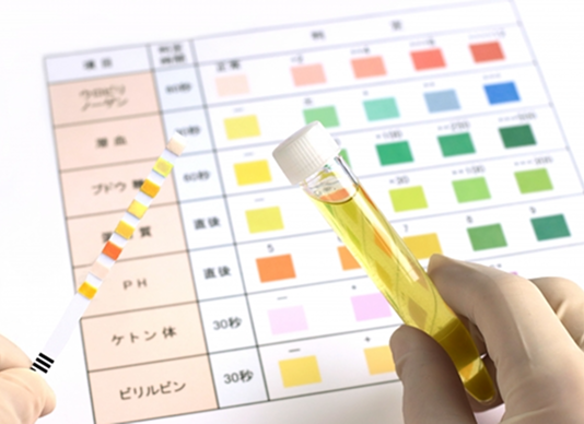 泌尿器科の診察で使用する専門的な機器